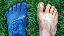 Thumbnail for 2 Years in Barefoot Shoes... My Feet Aren't The Same! | Mike Hanna