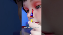 Thumbnail for Lego Stuck In Nose For 26 Years 😨 | Zack D. Films