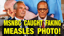 Thumbnail for NBC Doctored Up This Photo Of A Baby With Measles! | The Jimmy Dore Show