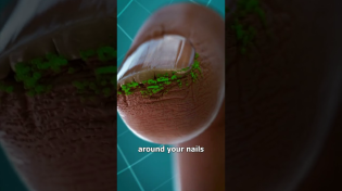 Thumbnail for Why You Shouldn't Bite Your Nails 😖 | Zack D. Films