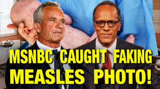 Thumbnail for NBC Doctored Up This Photo Of A Baby With Measles! | The Jimmy Dore Show